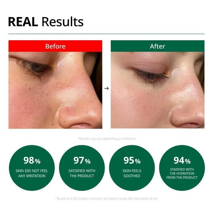 [Dr.G] Red Blemish Clear Soothing Cream